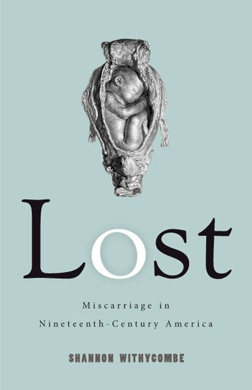 Book cover of Lost: Miscarriage in Nineteenth-Century America (Critical Issues in Health and Medicine)