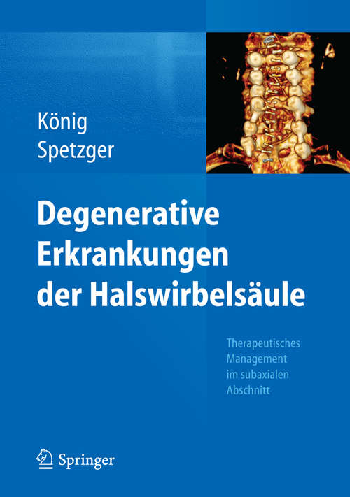 Book cover of Degenerative Erkrankungen der Halswirbelsäule