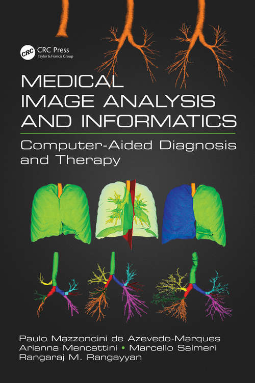 Medical Image Analysis and Informatics: Computer-Aided Diagnosis and Therapy