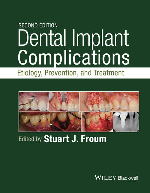 Book cover of Dental Implant Complications