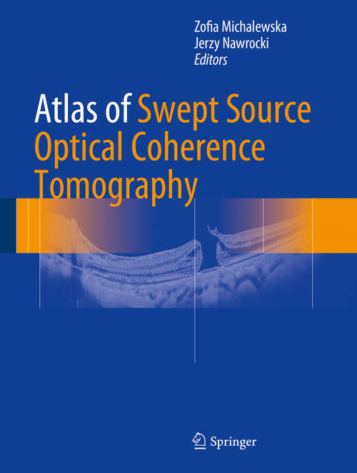 Book cover of Atlas of Swept Source Optical Coherence Tomography