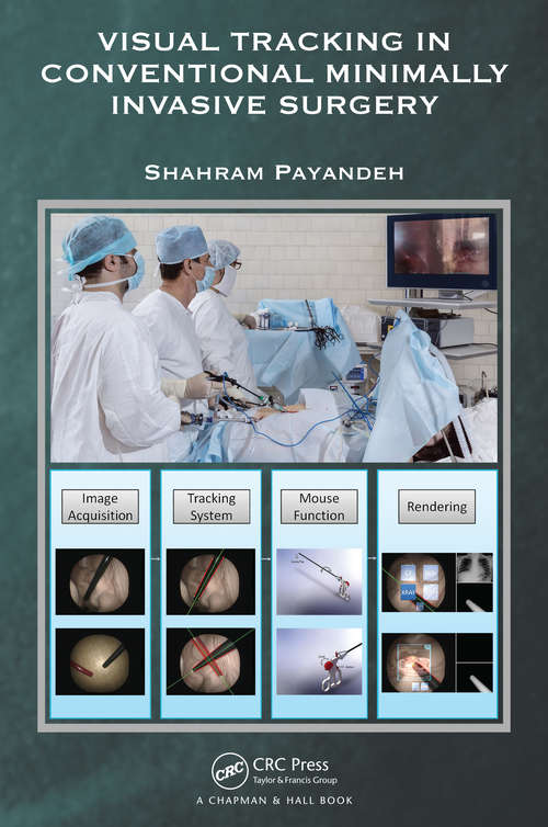 Book cover of Visual Tracking in Conventional Minimally Invasive Surgery