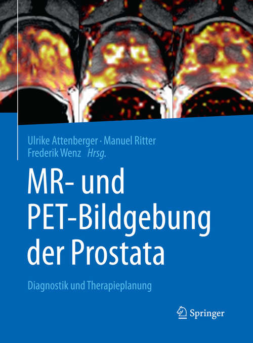 Book cover of MR- und PET-Bildgebung der Prostata