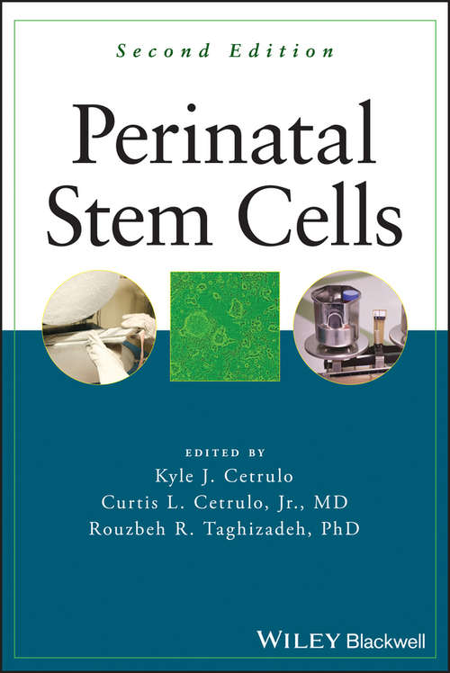 Book cover of Perinatal Stem Cells
