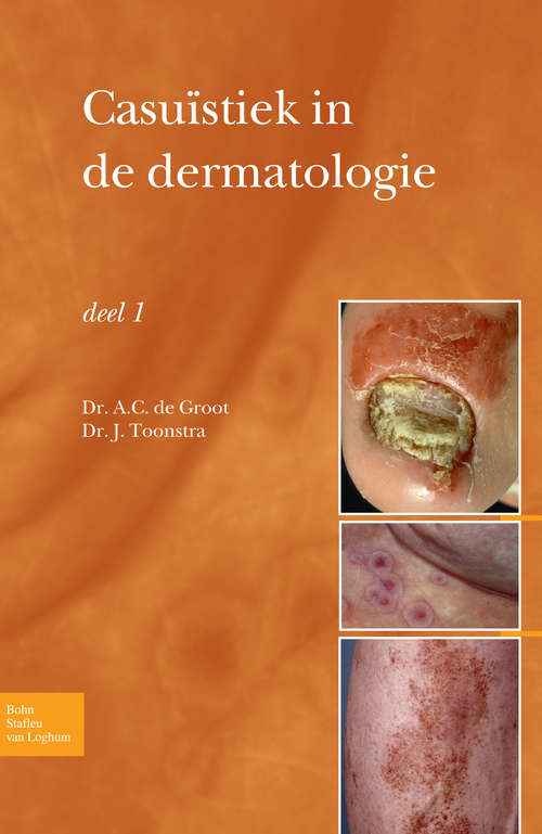 Book cover of Casuïstiek in de dermatologie - deel I