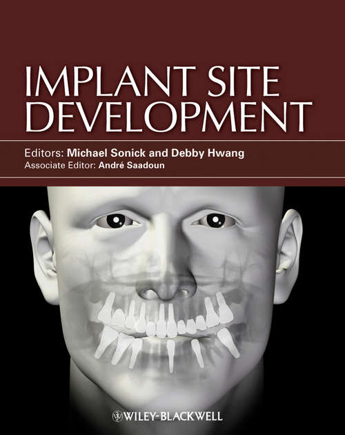 Book cover of Implant Site Development