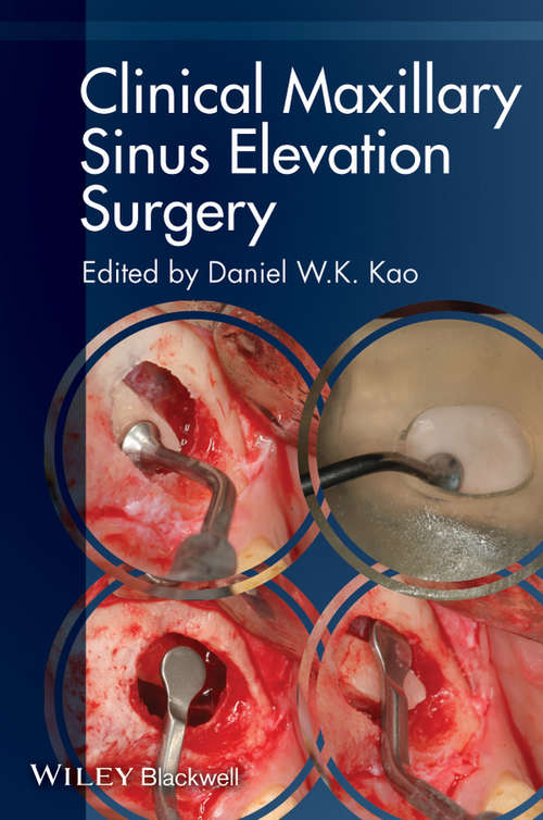Book cover of Clinical Maxillary Sinus Elevation Surgery