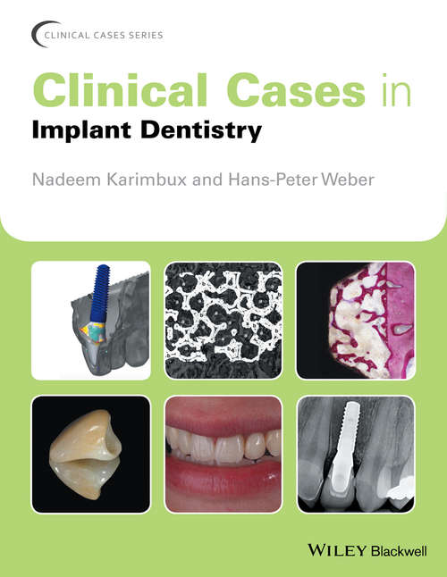 Clinical Cases in Implant Dentistry