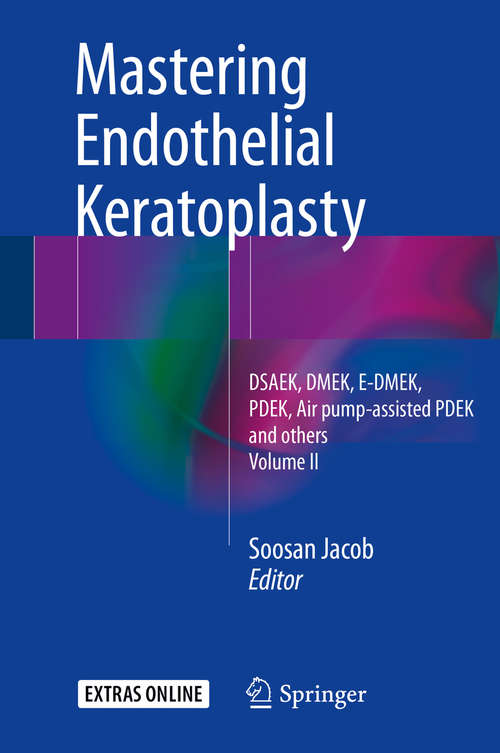 Book cover of Mastering Endothelial Keratoplasty