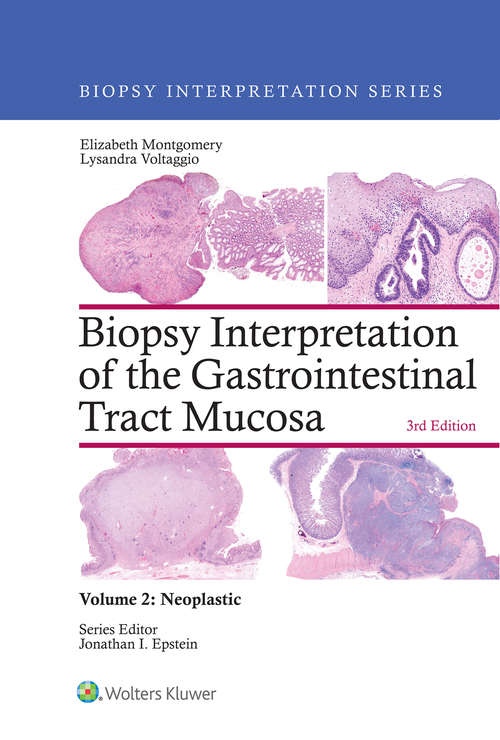 Book cover of Biopsy Interpretation of the Gastrointestinal Tract Mucosa: Volume 2: Neoplastic: Non-neoplastic (3) (Biopsy Interpretation Ser. #1)
