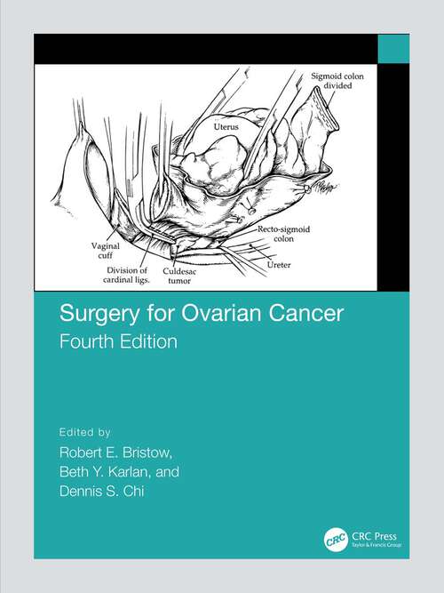 Book cover of Surgery for Ovarian Cancer: Principles And Practice (4)