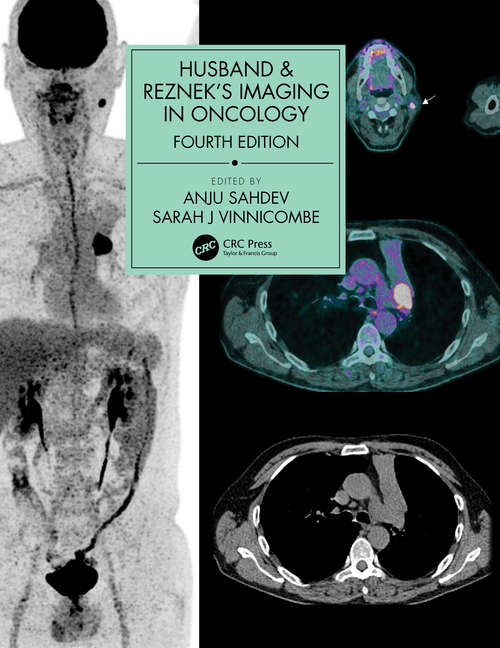 Book cover of Husband & Reznek's Imaging in Oncology (4)