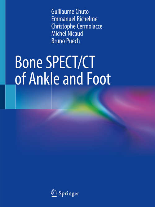 Book cover of Bone SPECT/CT of Ankle and Foot (1st ed. 2018)