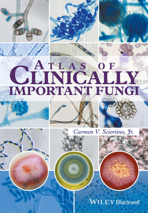 Book cover of Atlas of Clinically Important Fungi
