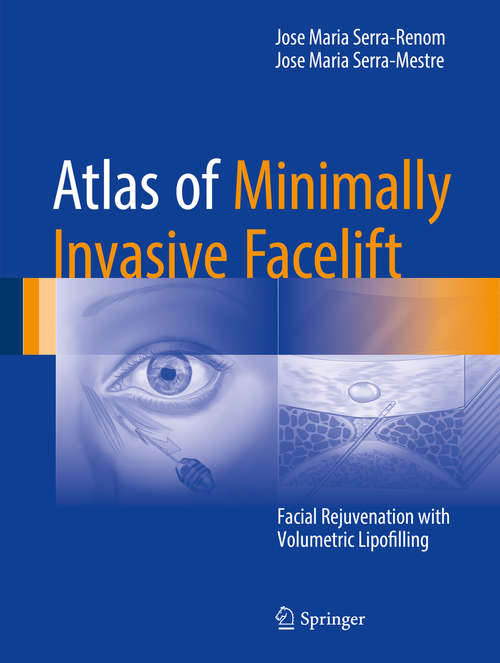 Atlas of Minimally Invasive Facelift: Facial Rejuvenation with Volumetric Lipofilling