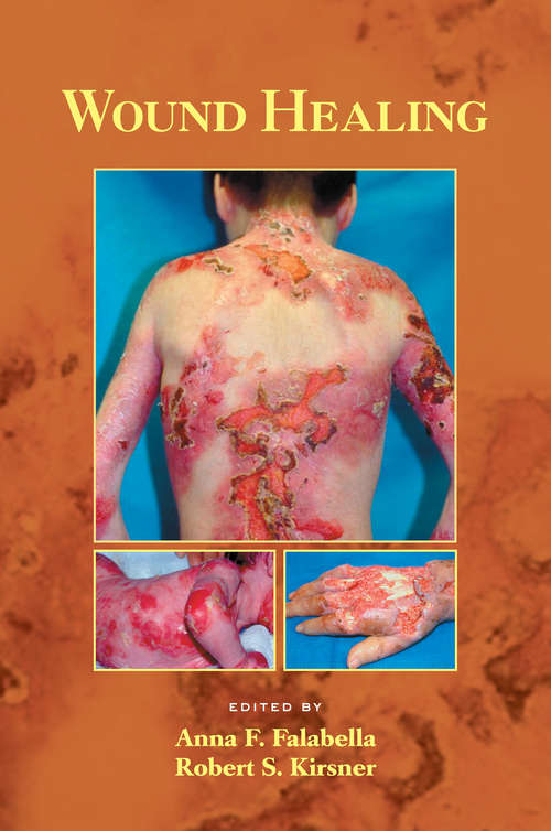 Book cover of Wound Healing