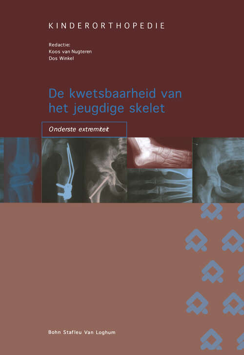 Book cover of Kinderorthopedie