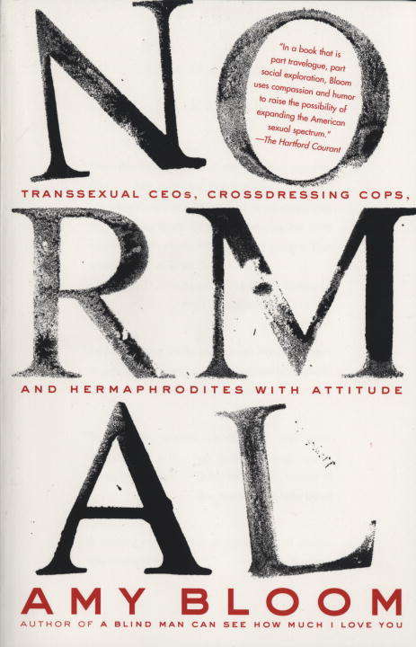 Book cover of Normal