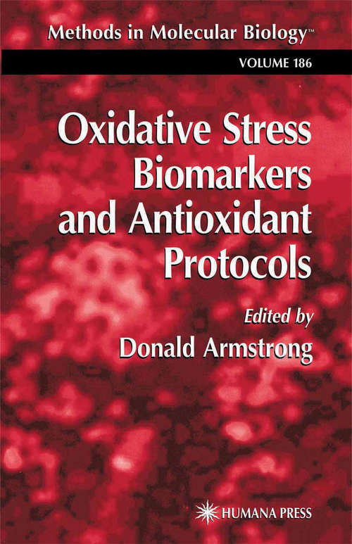 Oxidative Stress Biomarkers and Antioxidant Protocols