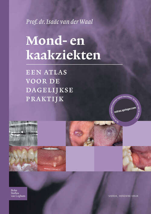 Book cover of Mond- en kaakziekten
