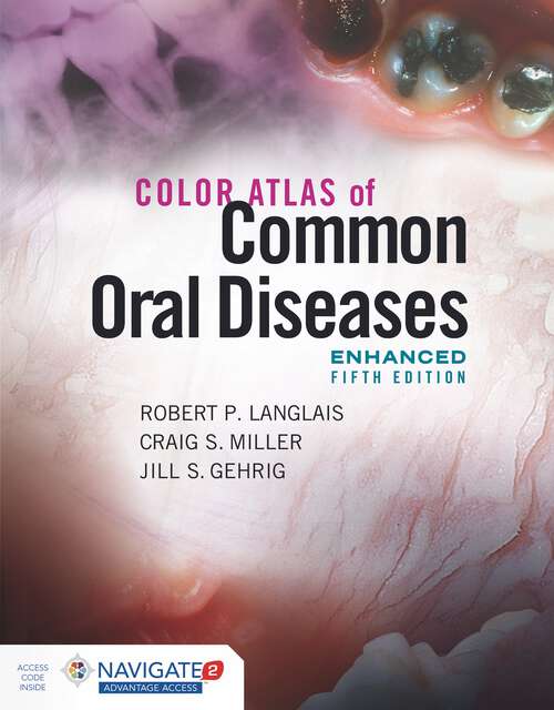 Book cover of Color Atlas of Common Oral Diseases, Enhanced Edition (5)