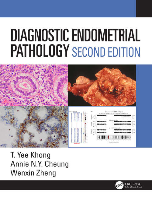 Diagnostic Endometrial Pathology 2E