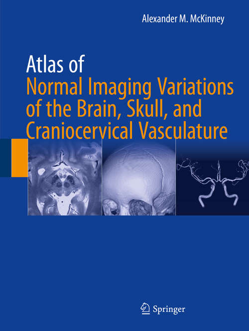 Book cover of Atlas of Normal Imaging Variations of the Brain, Skull, and Craniocervical Vasculature