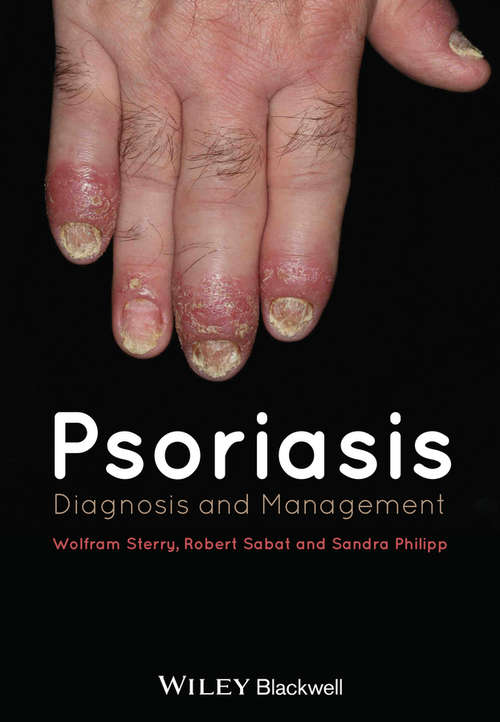 Book cover of Psoriasis