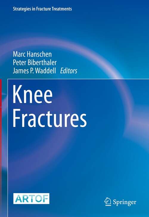 Book cover of Knee Fractures (1st ed. 2021) (Strategies in Fracture Treatments)