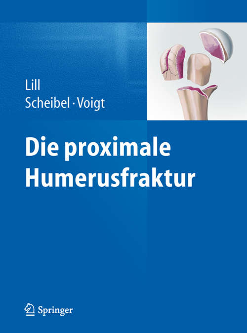Book cover of Die proximale Humerusfraktur