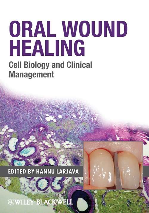 Book cover of Oral Wound Healing