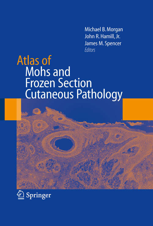 Atlas of Mohs and Frozen Section Cutaneous Pathology