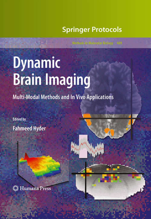 Book cover of Dynamic Brain Imaging