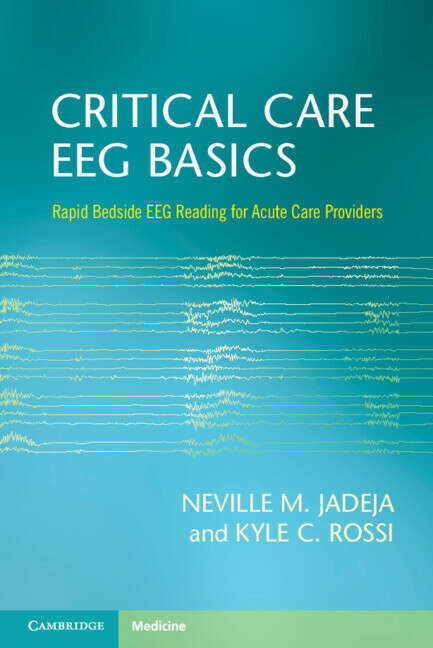 Book cover of Critical Care EEG Basics: Rapid Bedside EEG Reading for Acute Care Providers