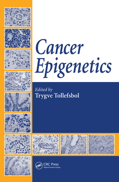 Book cover of Cancer Epigenetics