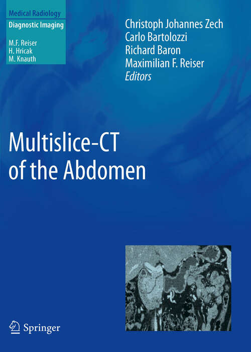 Book cover of Multislice-CT of the Abdomen