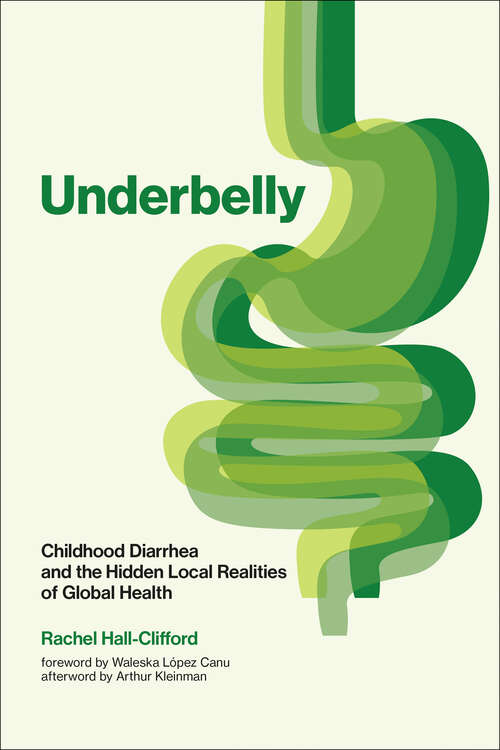 Book cover of Underbelly: Childhood Diarrhea and the Hidden Local Realities of Global Health