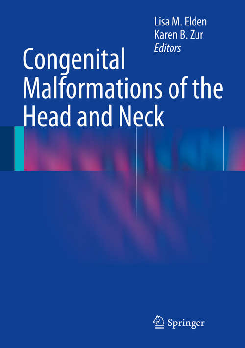 Book cover of Congenital Malformations of the Head and Neck