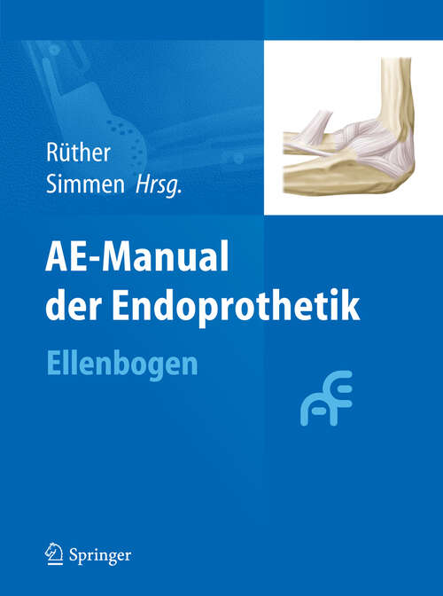 Book cover of AE-Manual der Endoprothetik: Ellenbogen