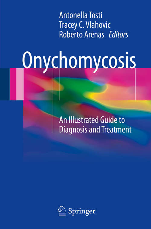 Book cover of Onychomycosis