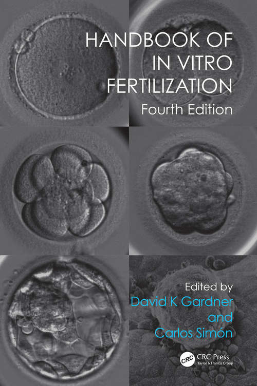 Book cover of Handbook of In Vitro Fertilization (4)