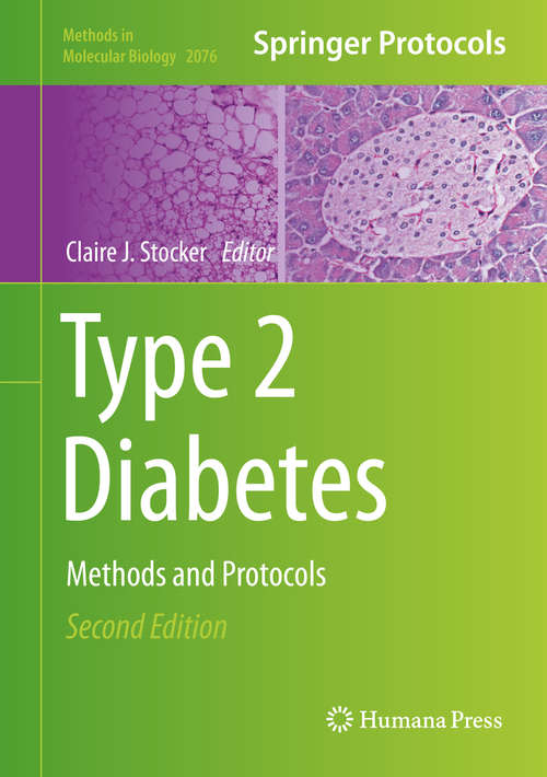 Type 2 Diabetes: Methods and Protocols (Methods in Molecular Biology #2076)