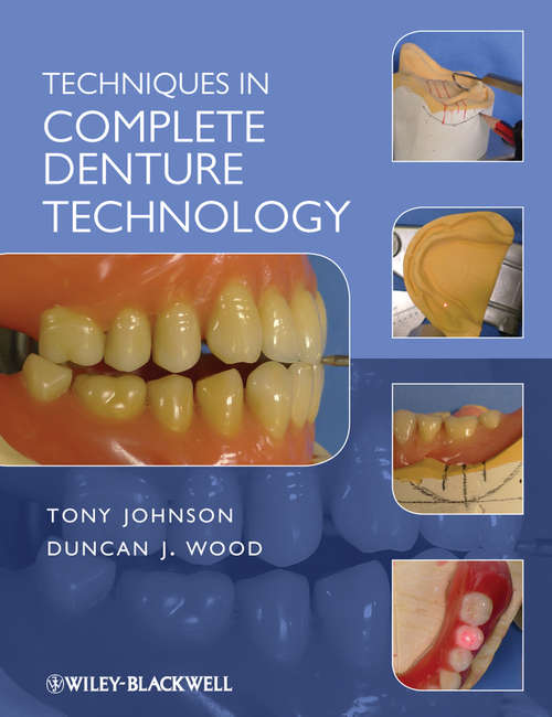 Techniques in Complete Denture Technology