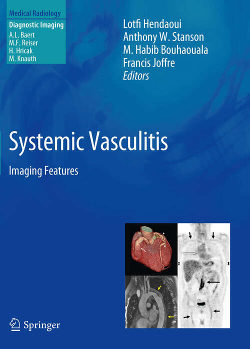 Book cover of Systemic Vasculitis