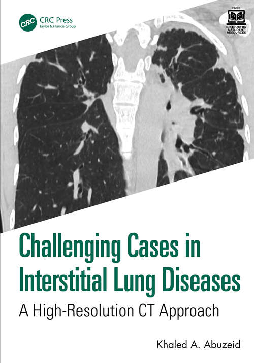 Book cover of Challenging Cases in Interstitial Lung Diseases: A High-Resolution CT Approach (1) (Challenging Cases)