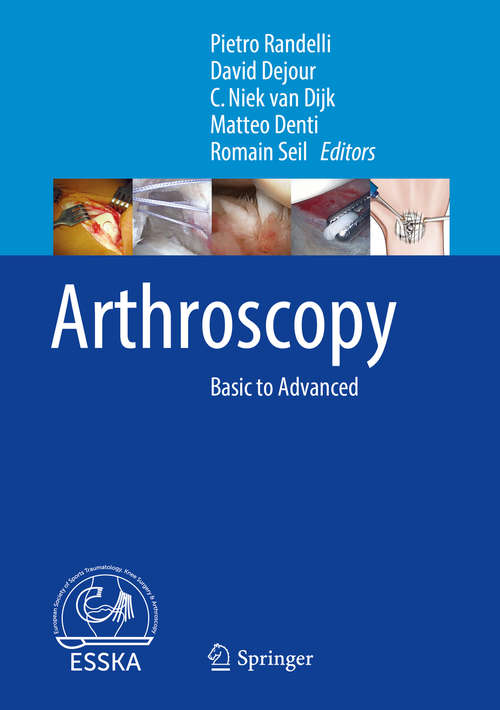 Arthroscopy: Basic to Advanced