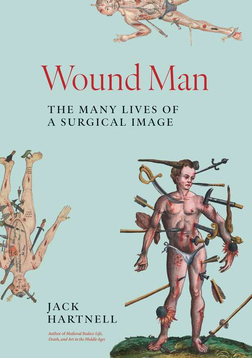 Book cover of Wound Man: The Many Lives of a Surgical Image