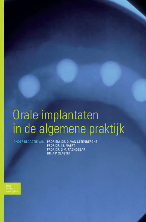 Orale implantaten in de algemene praktijk