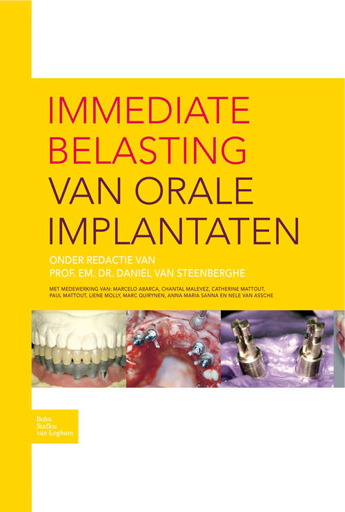 Book cover of Immediate belasting van orale implantaten