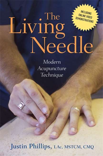 Book cover of The Living Needle: Modern Acupuncture Technique